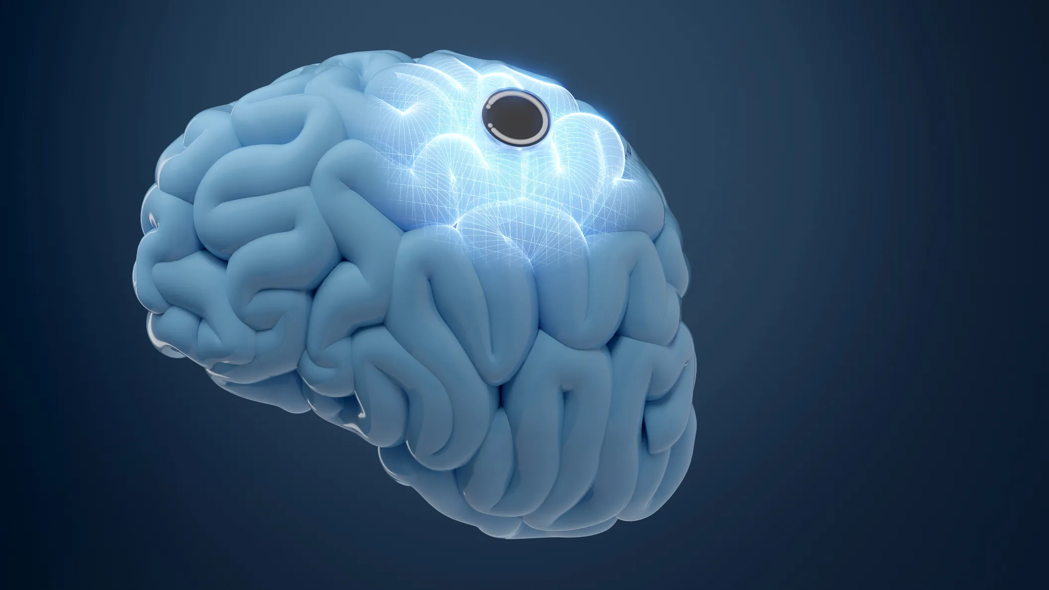 Avance en neurotecnología: los pensamientos ya pueden expresarse como voz en tiempo real