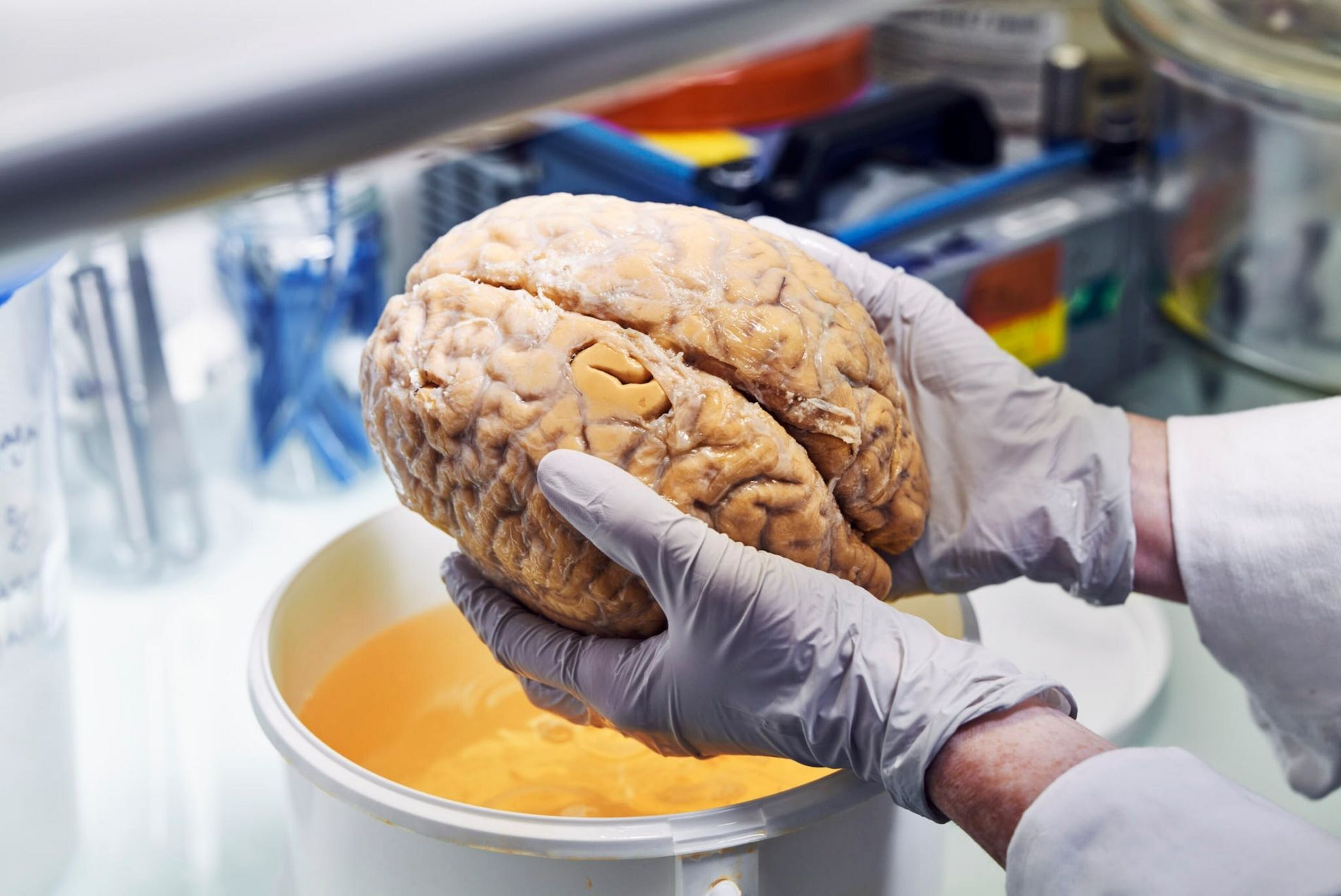 La pandemia impactó en el cerebro, incluso sin haber tenido COVID
