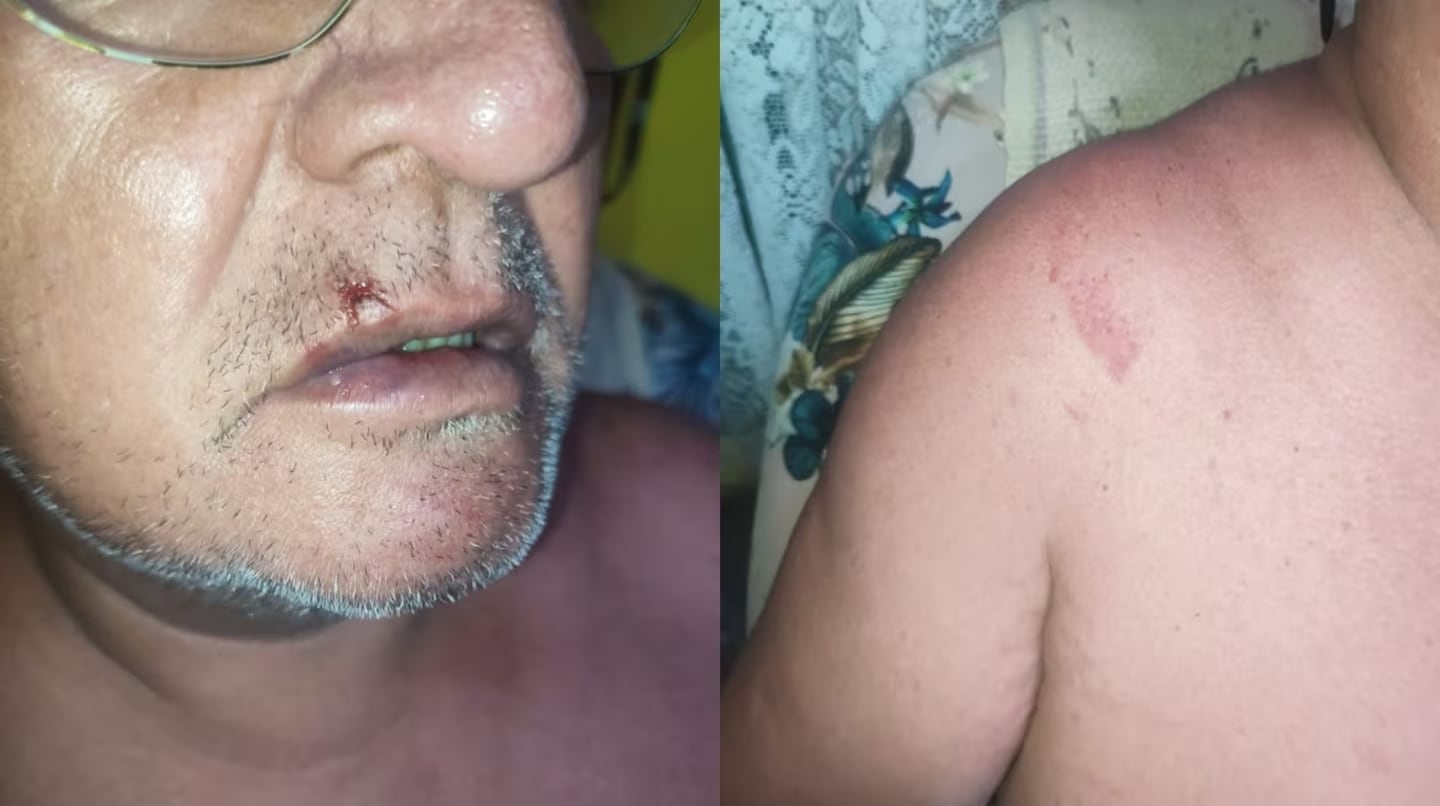 La angustia del turista que se agarró a piñas con cuatro guardavidas en Chubut: “No quiero salir a la calle”