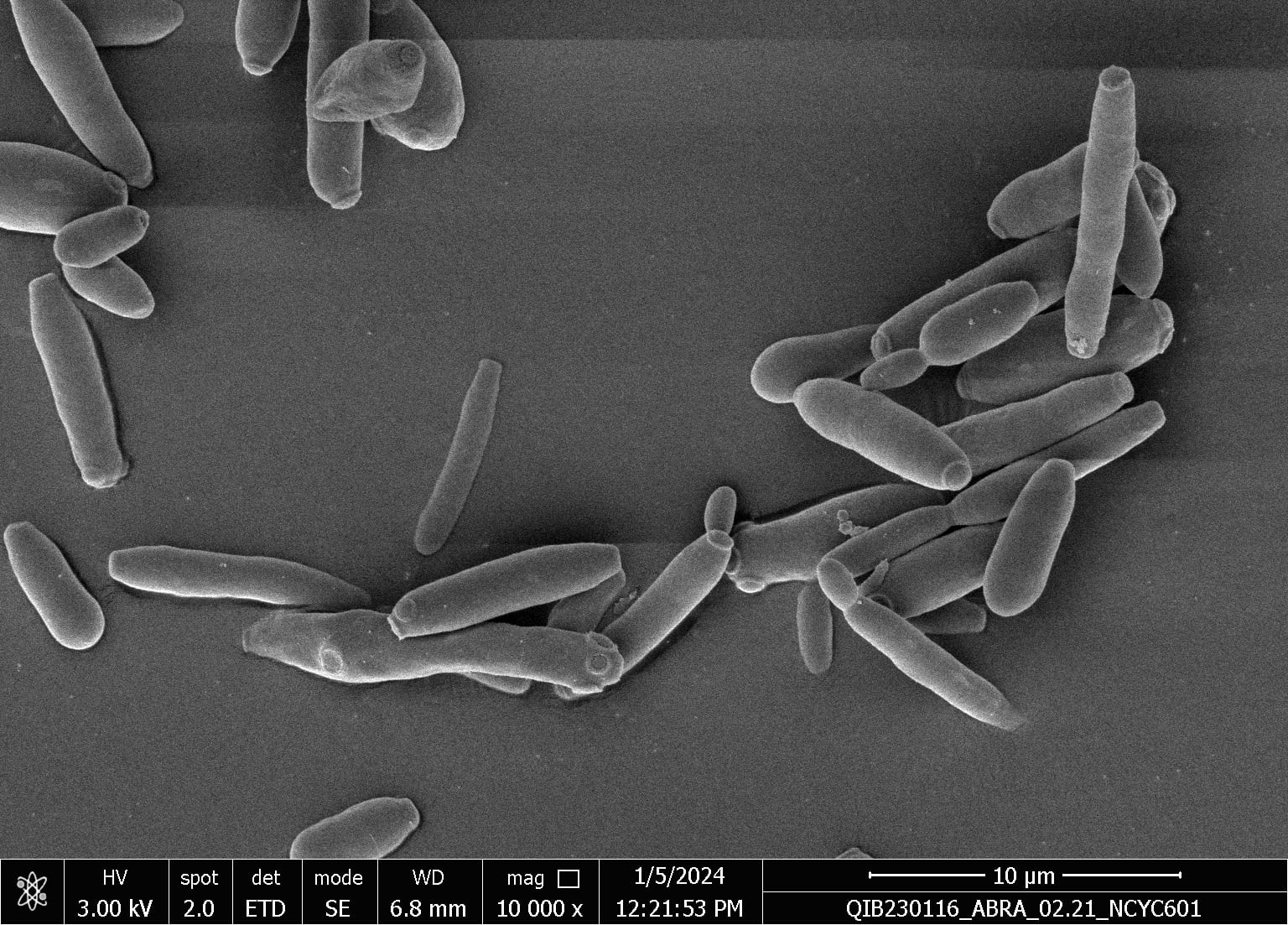Advierten sobre la cándida parapsilosis, un hongo de alta resistencia y rápida propagación