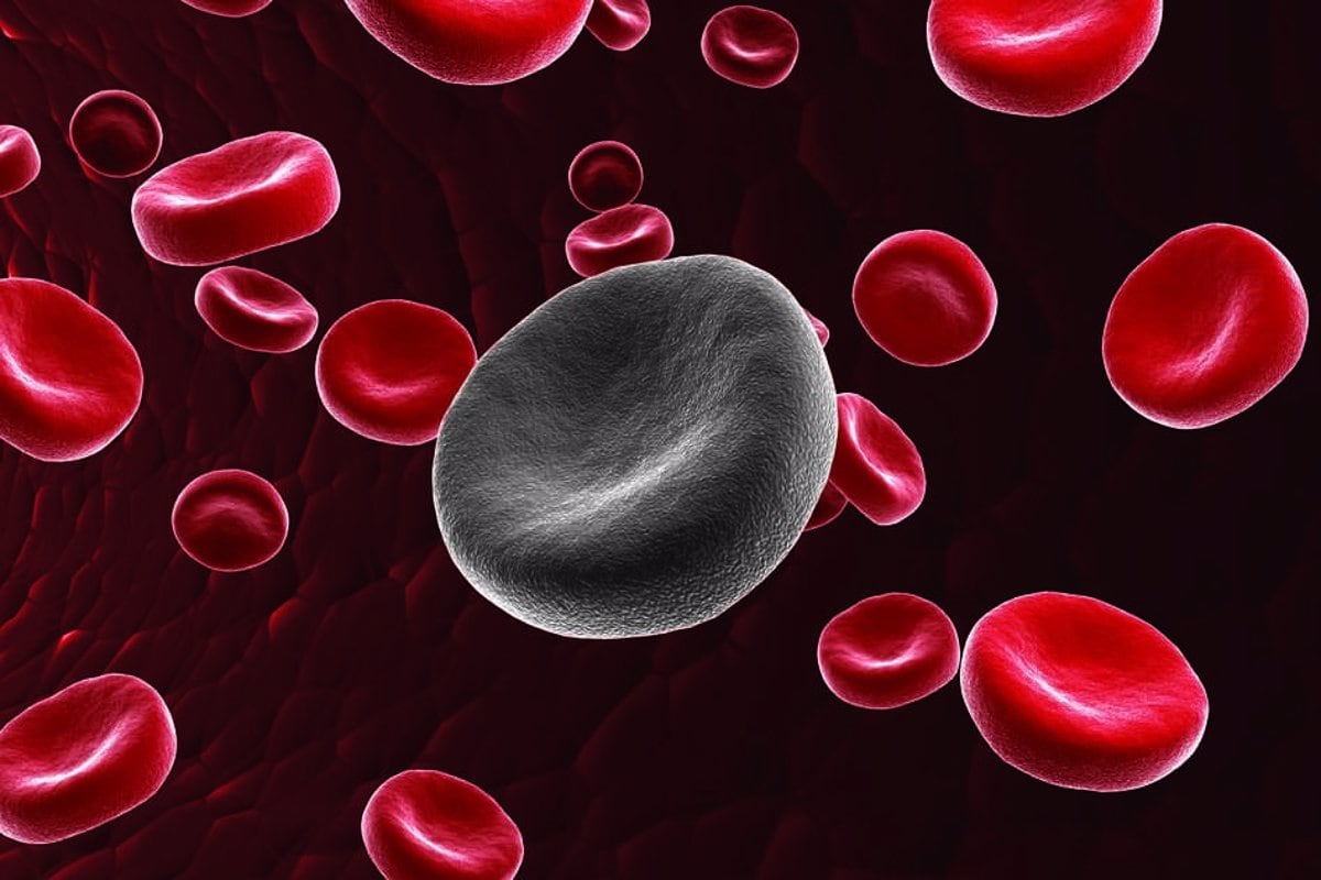 Avances Esperanzadores: Innovadora Terapia Inmunitaria Contra la Leucemia