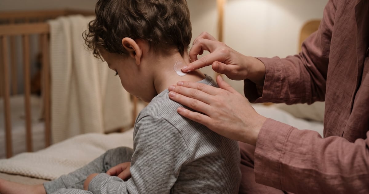 Dermatitis atópica: barreras económicas frenan el tratamiento de una enfermedad que no da tregua